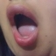 Annya