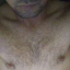Sub_Leo_MT