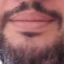 Rodmg