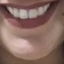 sublarissa