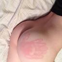Spanking
